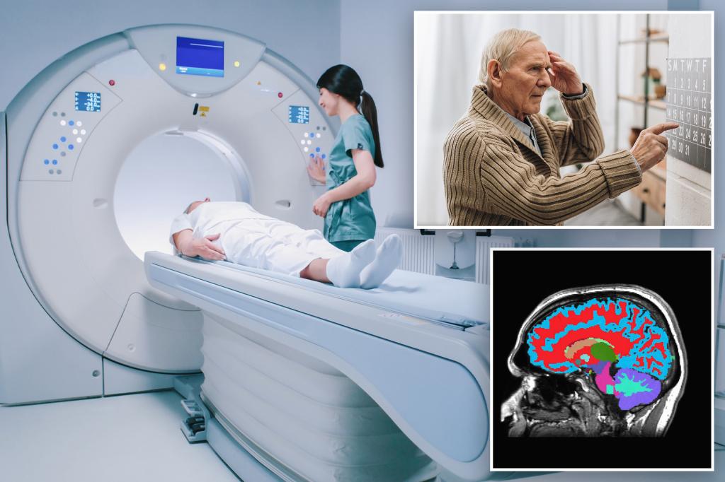 AI Brain Scan Tool Using 50,000 MRIs Predicts Aging Speed, Dementia ...