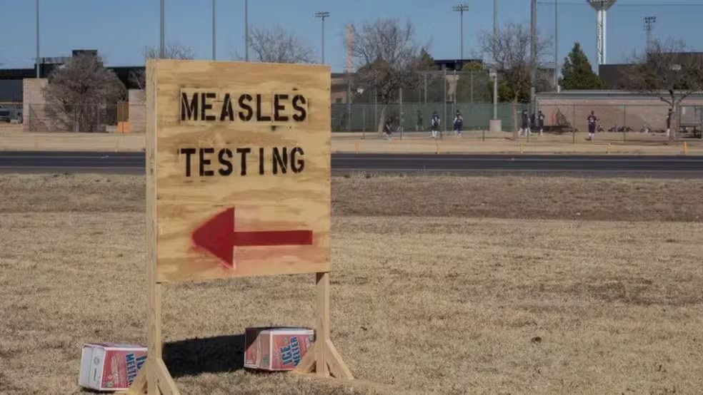 Measles Outbreak Kills Second Child in Southwestern US, 642 Confirmed ...