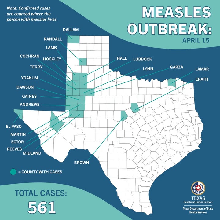 Texas Measles Outbreak Grows to 561 Cases, 20 New Infections, 58 ...